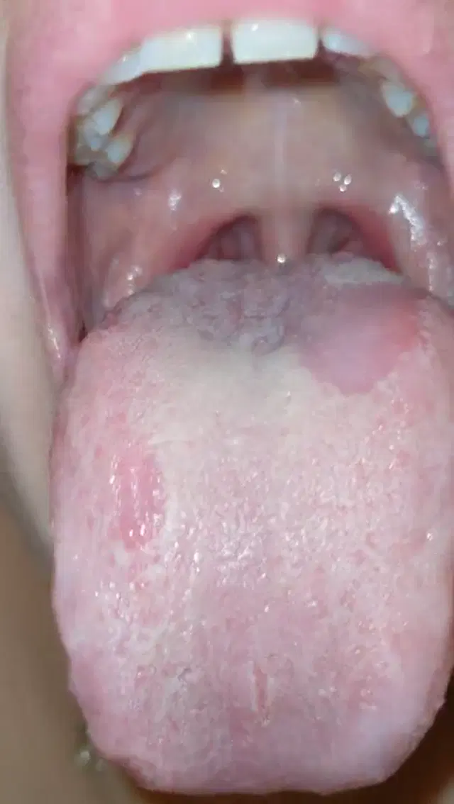 Pink Throat Princess – Morning Breath
